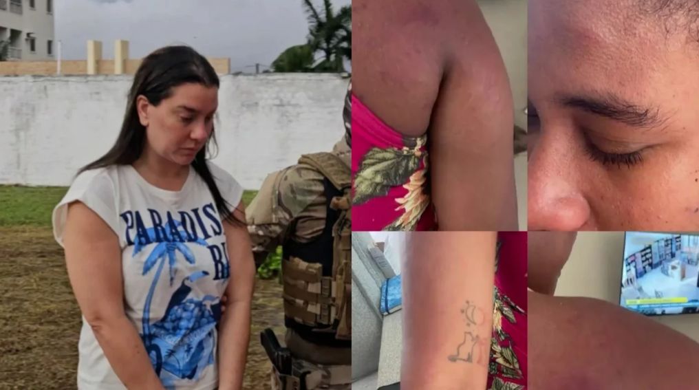 Grávida agredida por patroa relata perda parcial da audição após violência no Maranhão
